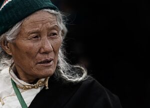 ニキビができる原因は何？知りたいあなたへの解説