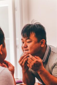 ニキビ予防における重要なポイントとは？