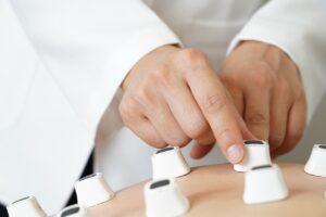 ニキビ治療クリニックの比較はどれが最適？